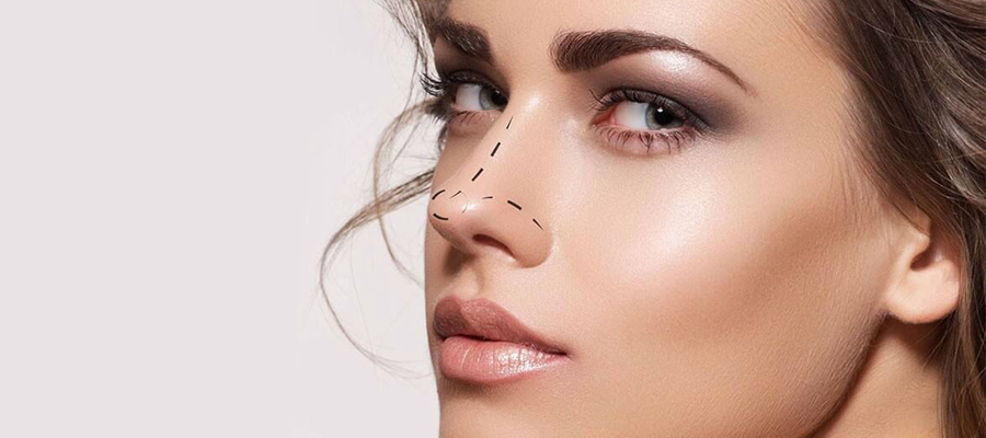 Rhinoplastie